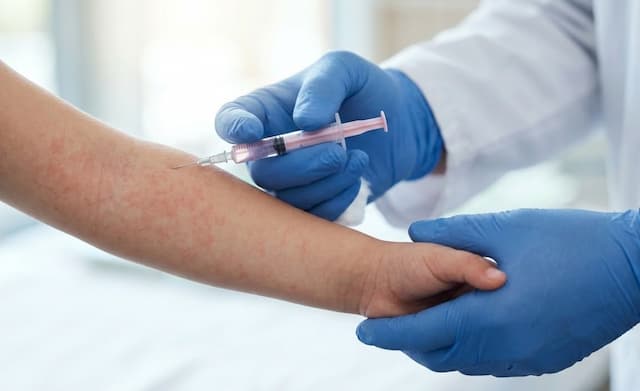 Kronologi Meninggalnya Dokter di Cianjur usai Tertular Campak saat Bertugas Kronologi Meninggalnya Dokter di Cianjur usai Tertular Campak saat Bertugas