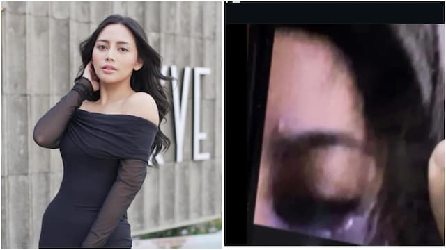 Rachel Vennya Diduga Alami Kekerasan Fisik hingga Mata Bonyok, Faktanya Mengejutkan! Rachel Vennya Diduga Alami Kekerasan Fisik hingga Mata Bonyok, Faktanya Mengejutkan!