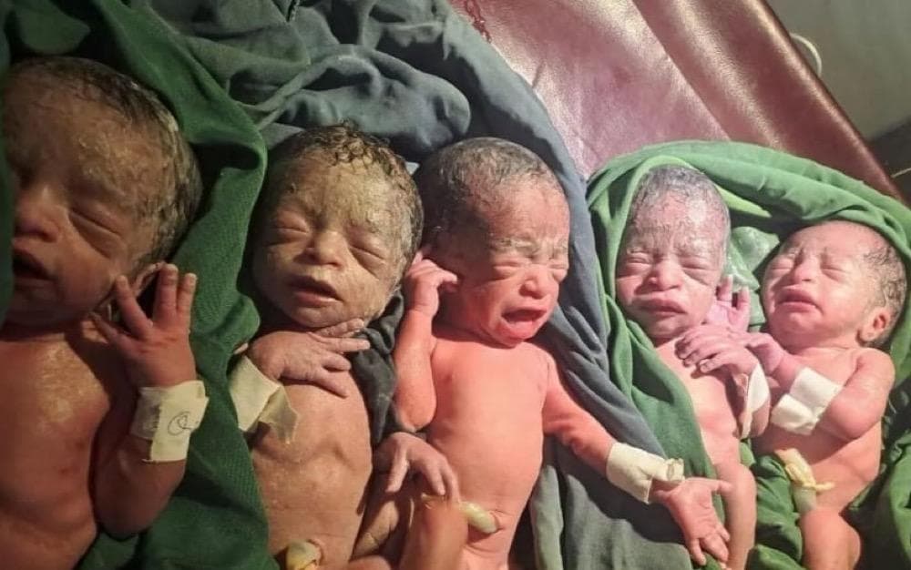 12 Tahun Nantikan Anak, Perempuan Ini Lahirkan Bayi Kembar 5 12 Tahun Nantikan Anak, Perempuan Ini Lahirkan Bayi Kembar 5