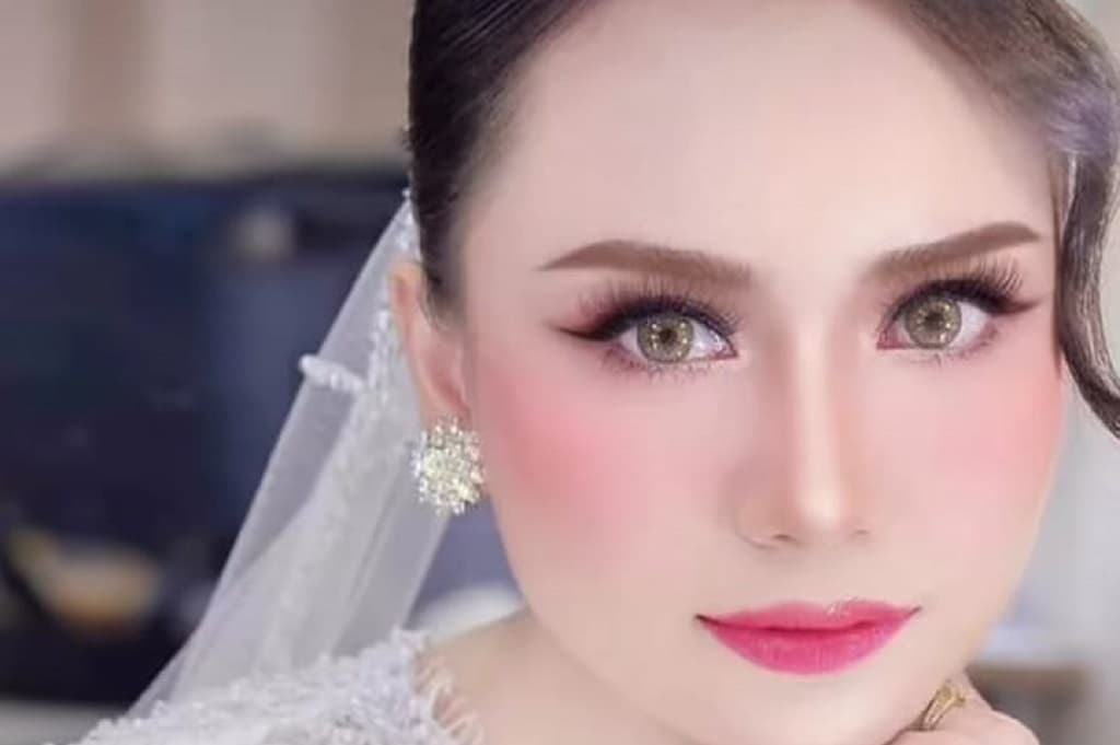 Sebar Hoaks, Model Ansy Jan De Vries Ternyata Alami Bisul Pecah Bukan Dibacok Begal Sebar Hoaks, Model Ansy Jan De Vries Ternyata Alami Bisul Pecah Bukan Dibacok Begal