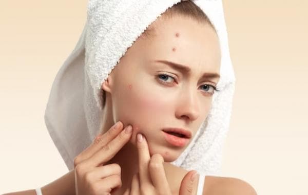 4 Ciri Perempuan Memiliki Nafsu yang Tinggi Salah satunya Berjerawat, Begini Penjelasannya 4 Ciri Perempuan Memiliki Nafsu yang Tinggi Salah satunya Berjerawat, Begini Penjelasannya