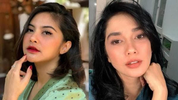 Deretan Artis Hapus Tahi Lalat di Wajah, Apa Alasannya Deretan Artis Hapus Tahi Lalat di Wajah, Apa Alasannya