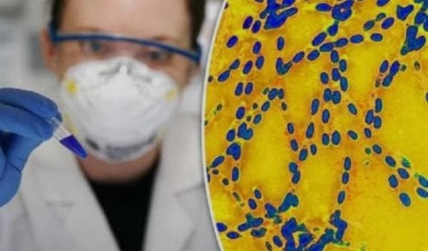 Mengenal Antraks, Penyakit Hewan yang Menular ke Manusia, Kenali Jenis, Gejala, dan Pencegahannya Mengenal Antraks, Penyakit Hewan yang Menular ke Manusia, Kenali Jenis, Gejala, dan Pencegahannya