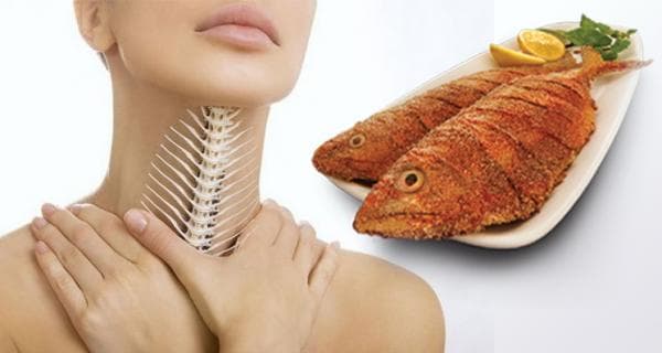 5 Tips Mengatasi Duri Ikan Tersangkut di Tenggorokan agar Tak Infeksi 5 Tips Mengatasi Duri Ikan Tersangkut di Tenggorokan agar Tak Infeksi