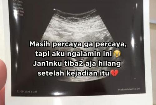 Ngeri, Kisah Ibu Kehilangan Janin secara Misterius usai Boncengkan Nenek-nenek Ngeri, Kisah Ibu Kehilangan Janin secara Misterius usai Boncengkan Nenek-nenek