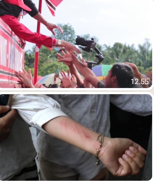 Berebut Uang, Sejumlah Warga Terluka Saat Kampanye PA di Nagan Raya