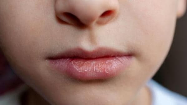 Tetap Lembap dan Sehat, Ini 4 Tips Cegah Bibir Kering saat Puasa