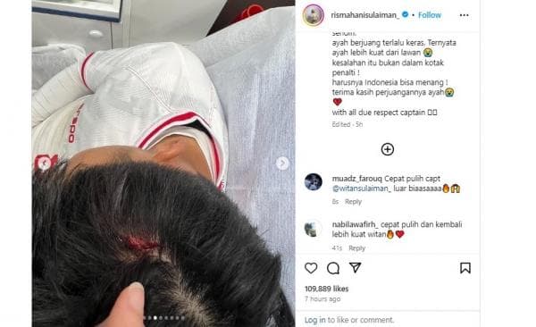 Pesan Menyentuh Istri Witan Sulaiman usai Kepala Suaminya Bocor dan Dapat 5 Jahitan Pesan Menyentuh Istri Witan Sulaiman usai Kepala Suaminya Bocor dan Dapat 5 Jahitan