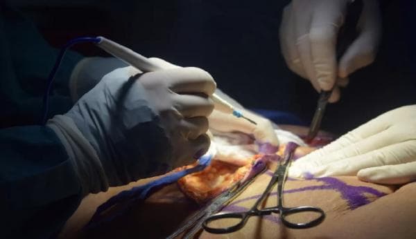 Edan! Dokter Gadungan Operasi Pasien Modal Tutorial YouTube Edan! Dokter Gadungan Operasi Pasien Modal Tutorial YouTube