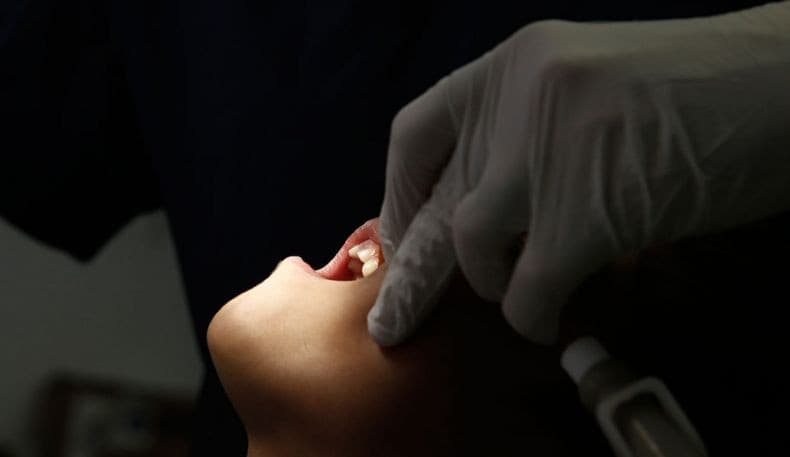 Pria Ini Meninggal Setelah Cabut Gigi, Kenapa? Pria Ini Meninggal Setelah Cabut Gigi, Kenapa?