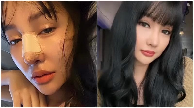 Oplas Lagi, Lucinta Luna Pamer Hidung Baru: Bye Bye Pinokio Oplas Lagi, Lucinta Luna Pamer Hidung Baru: Bye Bye Pinokio