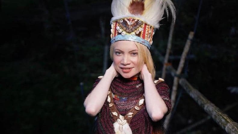 Potret Herolena, Gadis Albino asal Papua Barat yang Mirip Barbie Hidup Potret Herolena, Gadis Albino asal Papua Barat yang Mirip Barbie Hidup