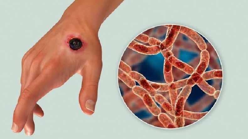 Senjata Biologis Pertama dalam Sejarah Manusia Senjata Biologis Pertama dalam Sejarah Manusia