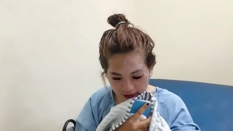 Janda Muda di Palembang Disiram Air Keras saat Jualan Es, Wajah dan Tangan Terluka Janda Muda di Palembang Disiram Air Keras saat Jualan Es, Wajah dan Tangan Terluka