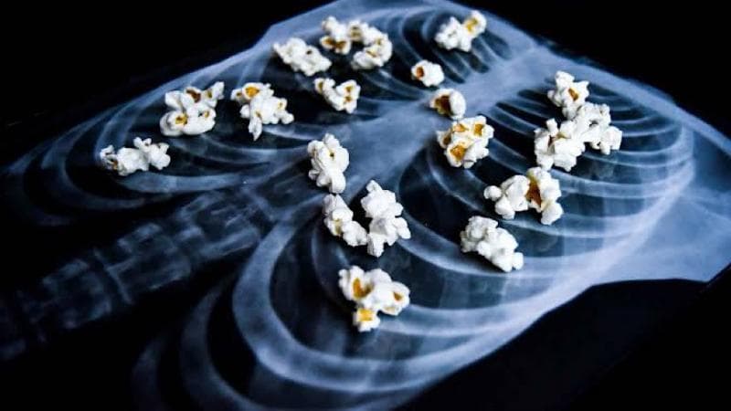 Waspadai Bahaya Vape Bagi Kesehatan Paru-Paru, Bisa Sebabkan Popcorn Lung Waspadai Bahaya Vape Bagi Kesehatan Paru-Paru, Bisa Sebabkan Popcorn Lung