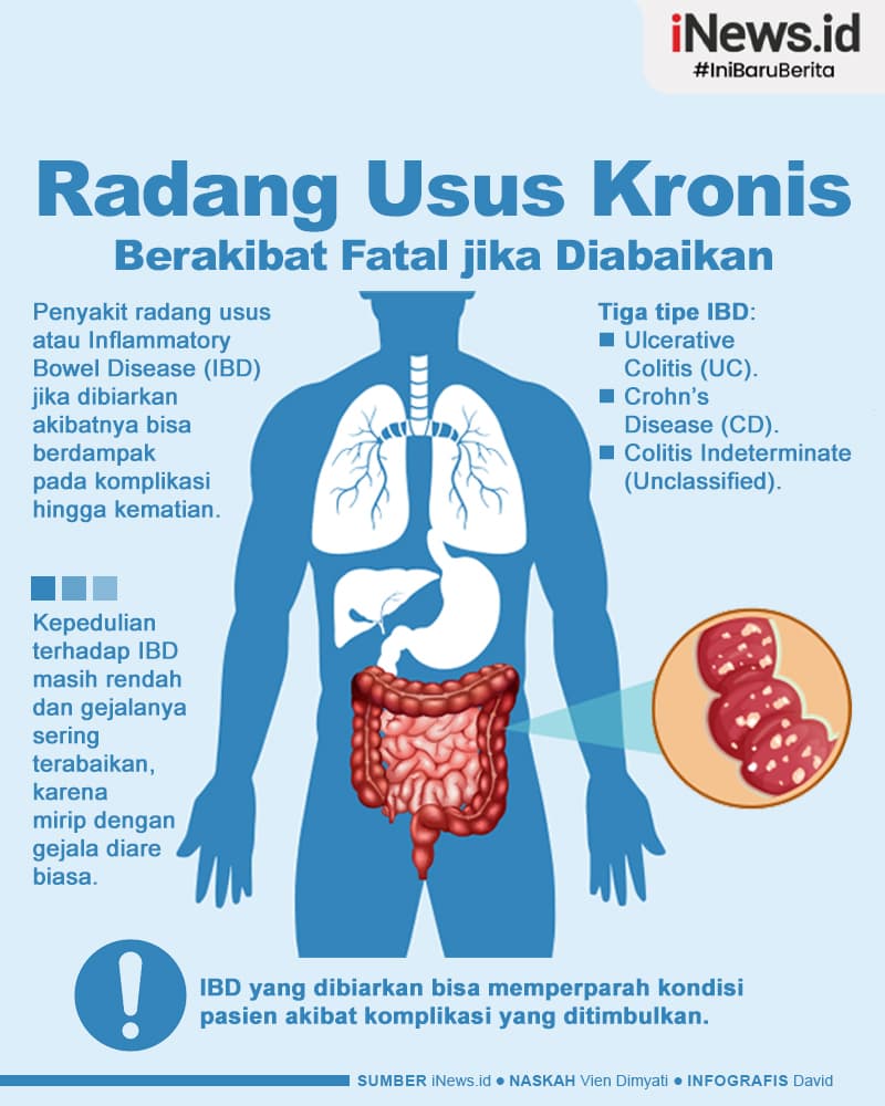 Infografis Radang Usus Kronis Bisa Berakibat Fatal jika Diabaikan Infografis Radang Usus Kronis Bisa Berakibat Fatal jika Diabaikan