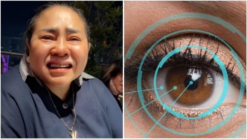 Mengenal Katarak Subkapsular Posterior yang Dialami Nunung, Lengkap dengan Gejalanya Mengenal Katarak Subkapsular Posterior yang Dialami Nunung, Lengkap dengan Gejalanya
