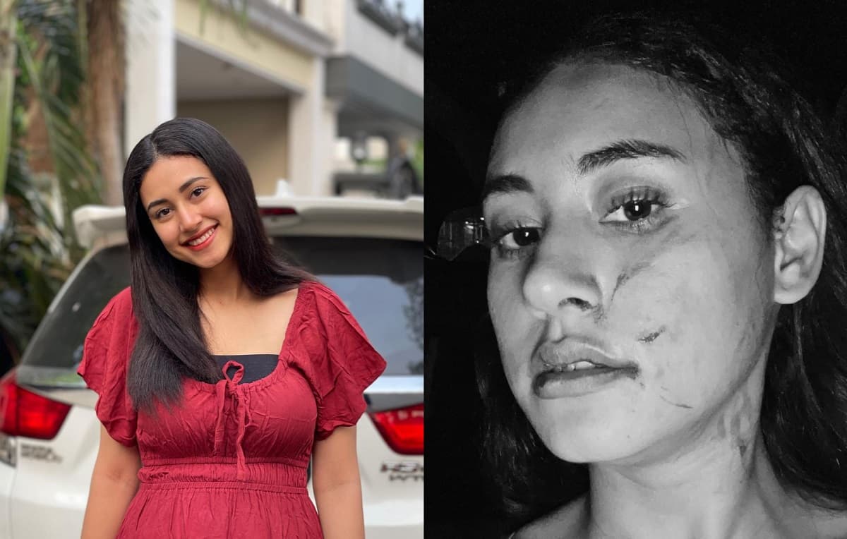 Selebgram Afifah Riyad Dihajar Mantan Pacar Suami, Wajah Sampai Babak Belur Selebgram Afifah Riyad Dihajar Mantan Pacar Suami, Wajah Sampai Babak Belur