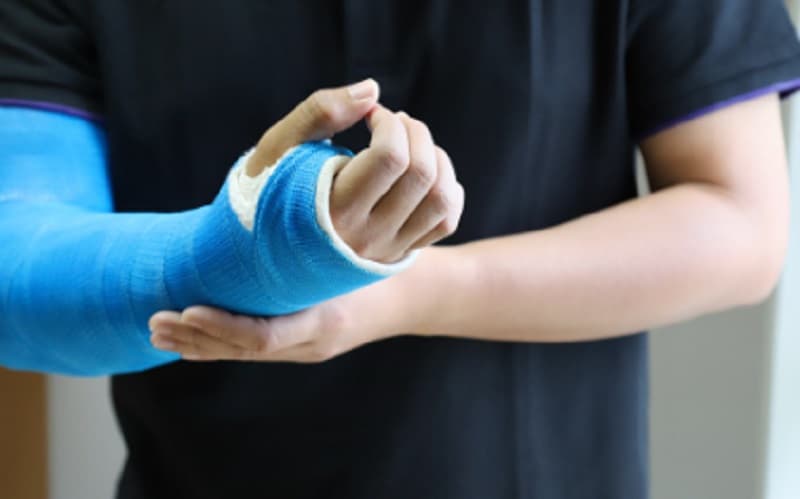 Patah Tulang, Berapa Lama Butuh Waktu untuk Sembuh? Patah Tulang, Berapa Lama Butuh Waktu untuk Sembuh?