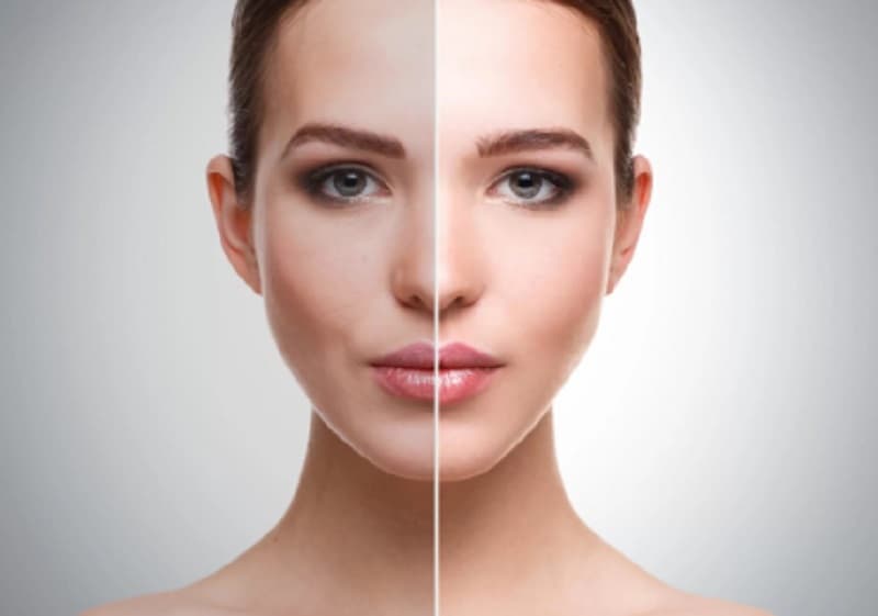 Terobsesi Kecantikan Wanita Sering Suntik Putih, Apa Bahayanya? Terobsesi Kecantikan Wanita Sering Suntik Putih, Apa Bahayanya?