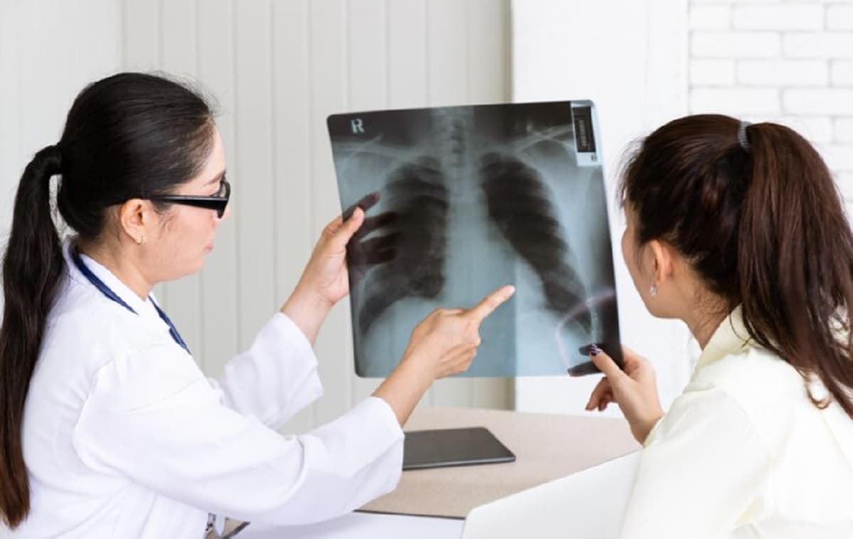 Penyakit Paru-Paru Basah Sama dengan Tuberkulosis? Ini Penjelasan Dokter Penyakit Paru-Paru Basah Sama dengan Tuberkulosis? Ini Penjelasan Dokter