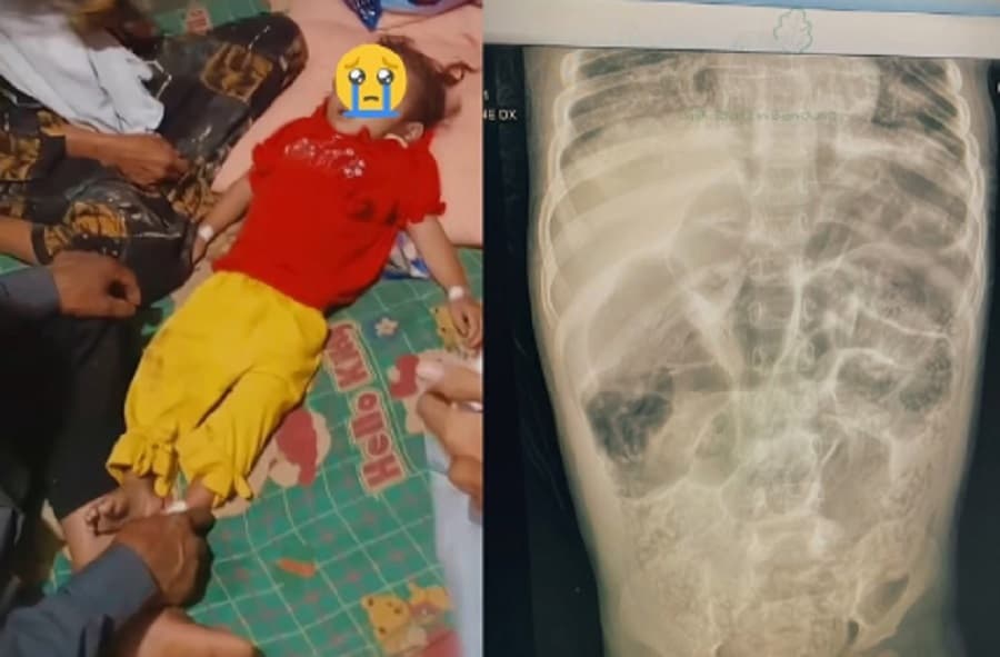 Kemenkes Selidiki Epidemiologi Buntut Kasus Kematian BalitaAkibat Infeksi Cacingan Kemenkes Selidiki Epidemiologi Buntut Kasus Kematian BalitaAkibat Infeksi Cacingan