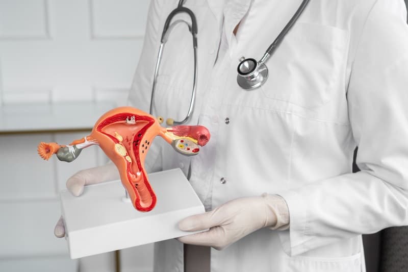 Nyeri Perut Hebat saat Haid, Waspada Endometriosis! Nyeri Perut Hebat saat Haid, Waspada Endometriosis!