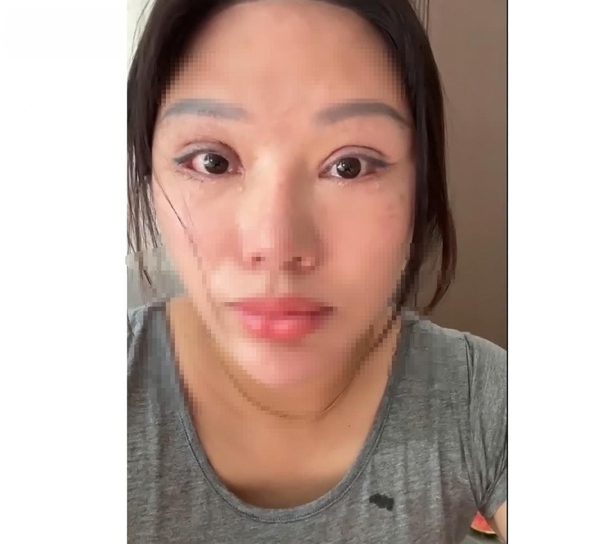 Viral! Perempuan Ini Tidak Bisa Tidur dengan Mata Tertutup Gegara Oplas Gagal Viral! Perempuan Ini Tidak Bisa Tidur dengan Mata Tertutup Gegara Oplas Gagal