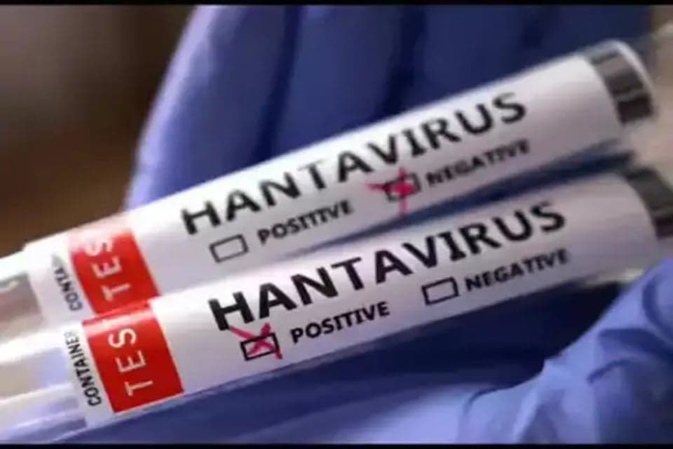 Ahli Epidemiologi Sebut Lingkungan Terbuka Lebih Aman dari Penularan Hantavirus Ahli Epidemiologi Sebut Lingkungan Terbuka Lebih Aman dari Penularan Hantavirus