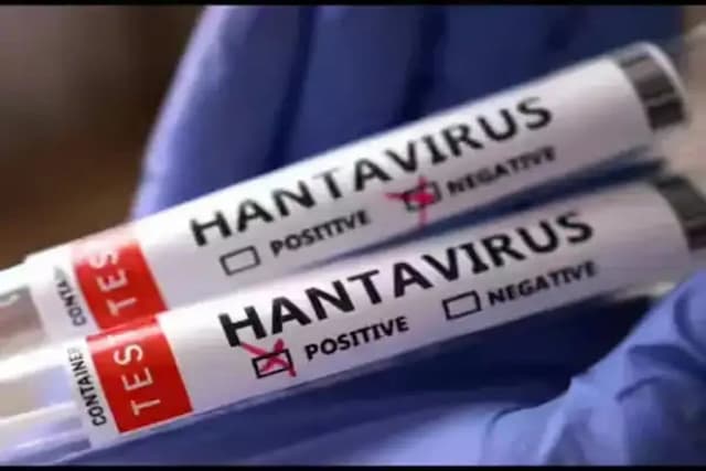 Ahli Epidemiologi Sebut Lingkungan Terbuka Lebih Aman dari Penularan Hantavirus Ahli Epidemiologi Sebut Lingkungan Terbuka Lebih Aman dari Penularan Hantavirus