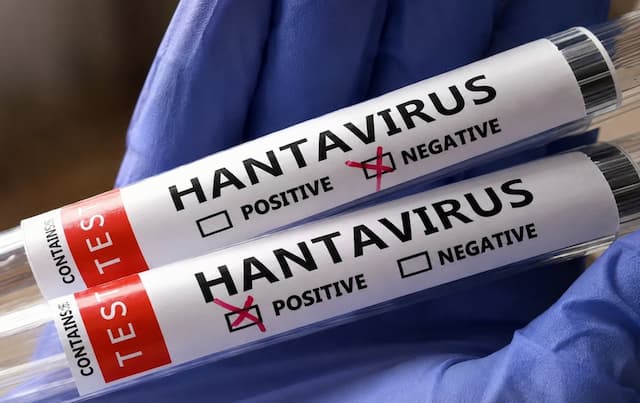 Waspada Hantavirus, Kenali Gejala, Penularan, dan Cara Mencegahnya Waspada Hantavirus, Kenali Gejala, Penularan, dan Cara Mencegahnya