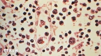Hubungan Virus Hanta dan Warisan Ilmuwan Korsel Terungkap Hubungan Virus Hanta dan Warisan Ilmuwan Korsel Terungkap