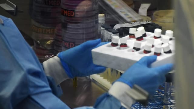 Laboratorium Biologi Rahasia AS di Ukraina Disorot setelah Peringatan Berulang dari Rusia Laboratorium Biologi Rahasia AS di Ukraina Disorot setelah Peringatan Berulang dari Rusia