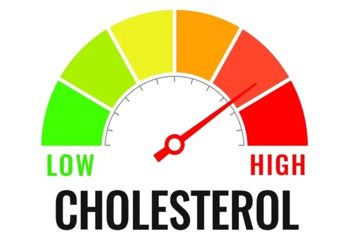 8 Cara Cegah Asam Urat dan Kolesterol Naik Saat Lebaran, Jangan Kalap Makan! 8 Cara Cegah Asam Urat dan Kolesterol Naik Saat Lebaran, Jangan Kalap Makan!