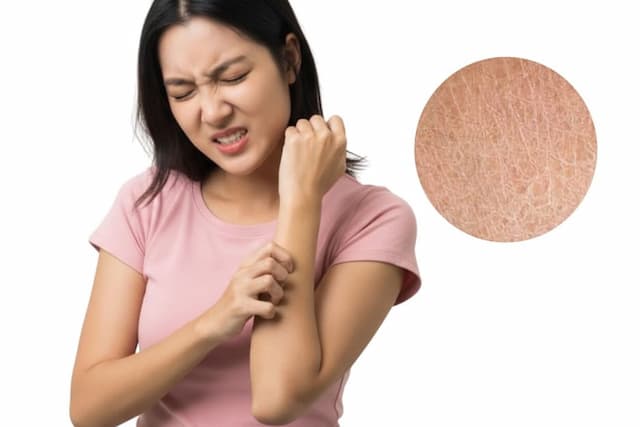 Perawatan Kulit Kering agar Tetap Lembap dan Nyaman, Ini Tips dari Pherini Body Wash Perawatan Kulit Kering agar Tetap Lembap dan Nyaman, Ini Tips dari Pherini Body Wash