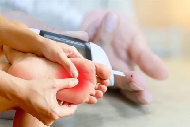 Suti Karno Amputasi Kaki Gegara Diabetes, Begini Tips Mencegahnya Agar Tak Semakin Parah Suti Karno Amputasi Kaki Gegara Diabetes, Begini Tips Mencegahnya Agar Tak Semakin Parah