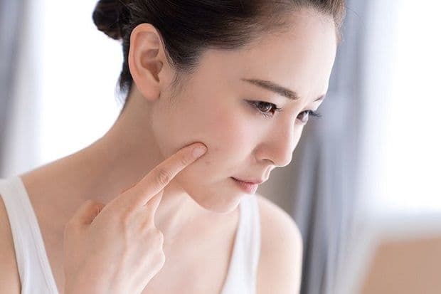 3 Bahan Alami untuk Hilangkan Bintik Hitam Bekas Jerawat, Nomor 2 Stabilkan Kadar Melanin 3 Bahan Alami untuk Hilangkan Bintik Hitam Bekas Jerawat, Nomor 2 Stabilkan Kadar Melanin