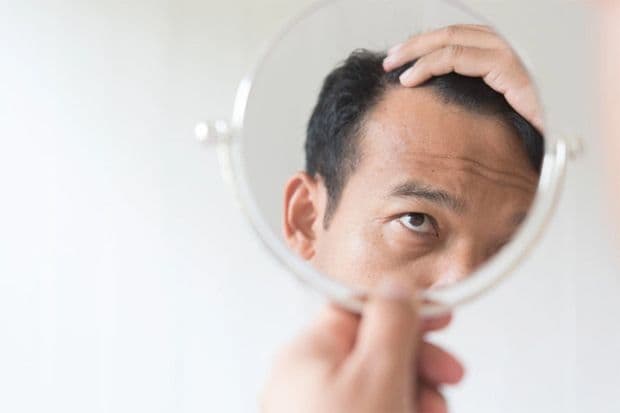 Menghadapi Kebotakan Secara Dini, Simak 5 Tips Menumbuhkan Rambut dan Merawatnya Menghadapi Kebotakan Secara Dini, Simak 5 Tips Menumbuhkan Rambut dan Merawatnya