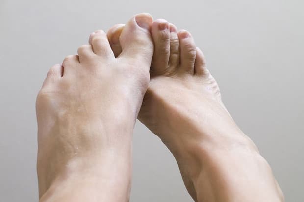 Apakah Gatal pada Kaki Menandakan Diabetes? Ini Penjelasannya Apakah Gatal pada Kaki Menandakan Diabetes? Ini Penjelasannya