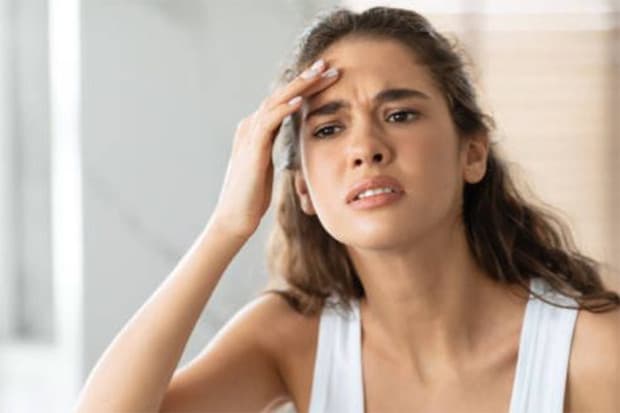 10 Cara Menghilangkan Bruntusan di Jidat, Pakai Bahan Alami Ini! 10 Cara Menghilangkan Bruntusan di Jidat, Pakai Bahan Alami Ini!