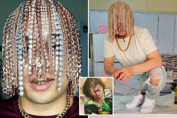Edan! Rapper Dan Sur Tanam Rantai Emas di Kulit Kepala Gantikan Rambut Edan! Rapper Dan Sur Tanam Rantai Emas di Kulit Kepala Gantikan Rambut