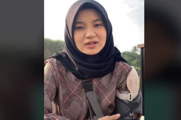 Viral! Gadis Belia asal Bandung Divonis Kanker Tulang, Gejala Awalnya Kerap Alami Pegal