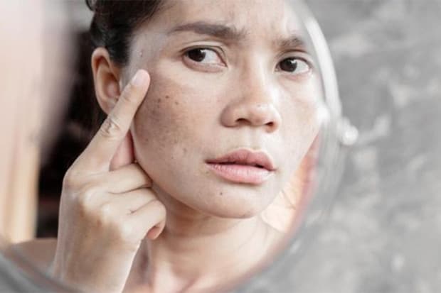 Benarkah Panas pada Kompor Bisa Sebabkan Flek Hitam? Ini Kata Ahli Benarkah Panas pada Kompor Bisa Sebabkan Flek Hitam? Ini Kata Ahli