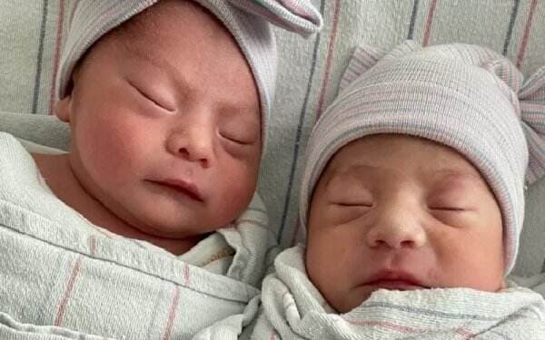 Unik, Bayi Kembar Ini Lahir di Tahun Berbeda di Akhir 2021 dan Awal 2022