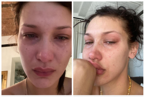 Bella Hadid Ungkap Fakta Dibalik Potret Mata Sembab Berlinang Air Mata di Instagram