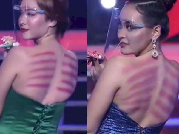Viral Lagi, 'Fashion Show' Seleb dengan Punggung Bekas Kerokan, Kompak Masuk Angin? Viral Lagi, 'Fashion Show' Seleb dengan Punggung Bekas Kerokan, Kompak Masuk Angin?