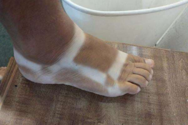 9 Momen lucu orang akibat terkena sinar matahari bikin ngakak sendiri 9 Momen lucu orang akibat terkena sinar matahari bikin ngakak sendiri