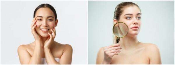 7 Manfaat belimbing wuluh untuk wajah, basmi noda membandel 7 Manfaat belimbing wuluh untuk wajah, basmi noda membandel