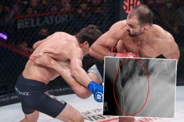 Brutal! 5 Tulang Rusuk Petarung MMA Patah Disodok Tendangan Putar Brutal! 5 Tulang Rusuk Petarung MMA Patah Disodok Tendangan Putar