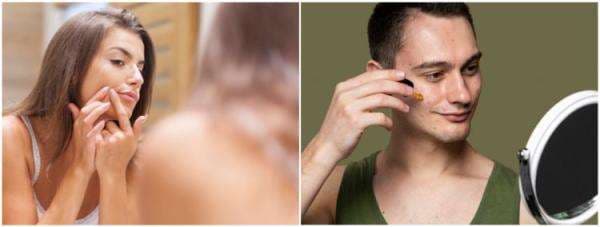 Rekomendasi 8 skincare Acnes yang ampuh atasi masalah jerawat Rekomendasi 8 skincare Acnes yang ampuh atasi masalah jerawat